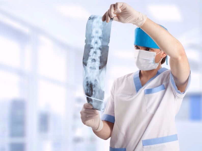 the doctor saw a picture of the cervical spine with osteochondrosis
