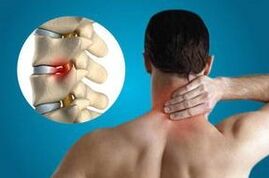 Pinch the vertebrae