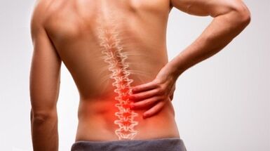 Signs and symptoms of lumbar spinal osteochondrosis