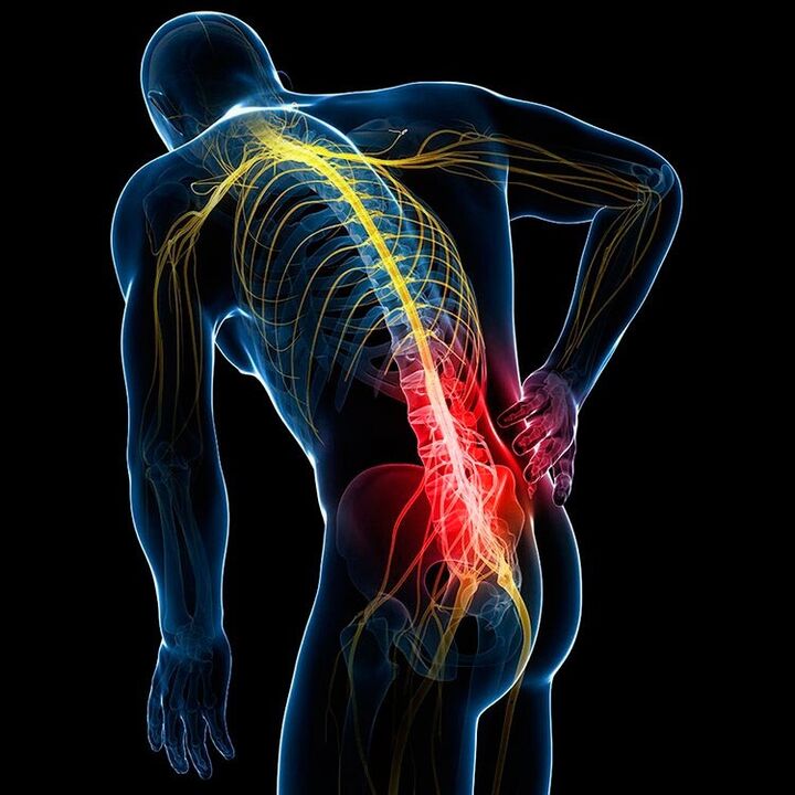 cause of back pain