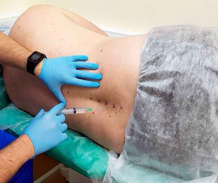 medical restrictions for the back