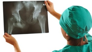 instrumental diagnosis of hip joint arthrosis