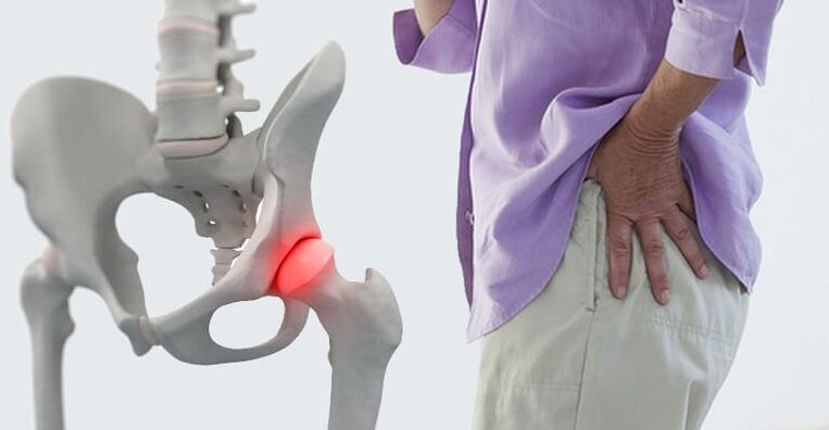 pain in the hip area - symptoms of arthrosis of the hip joint